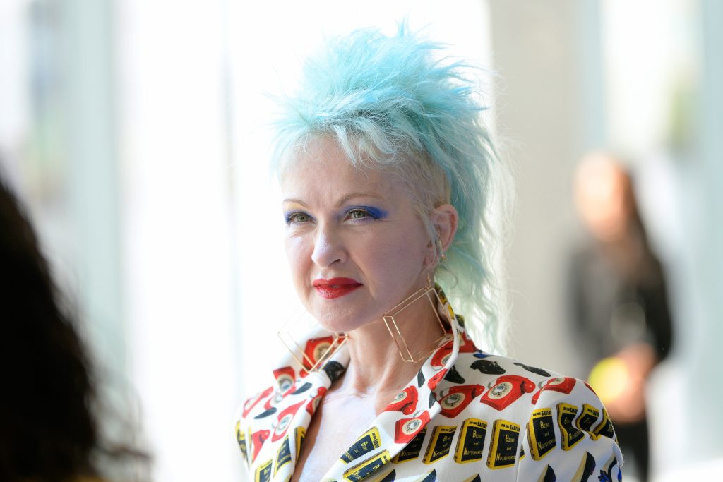 Cyndi Lauper. Celebs Who Have Living with Psoriasis