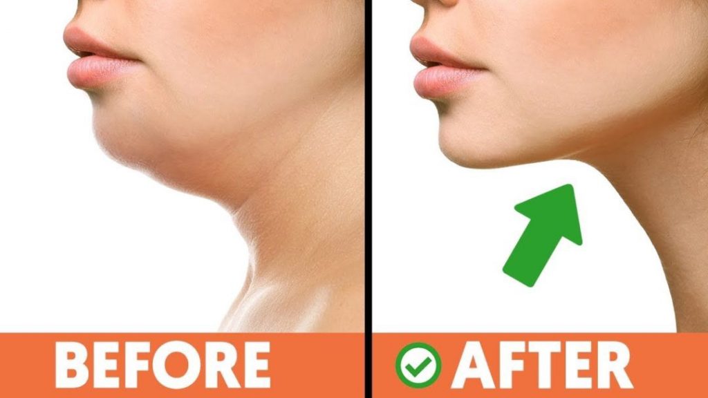 Exercises to Get Rid of a Double Chin. Get Rid of Double Chin Exercises