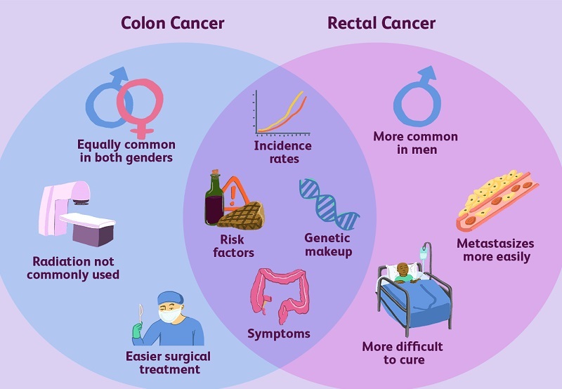 Reasons Why There’s a Low Cure Rate of Colon Cancer